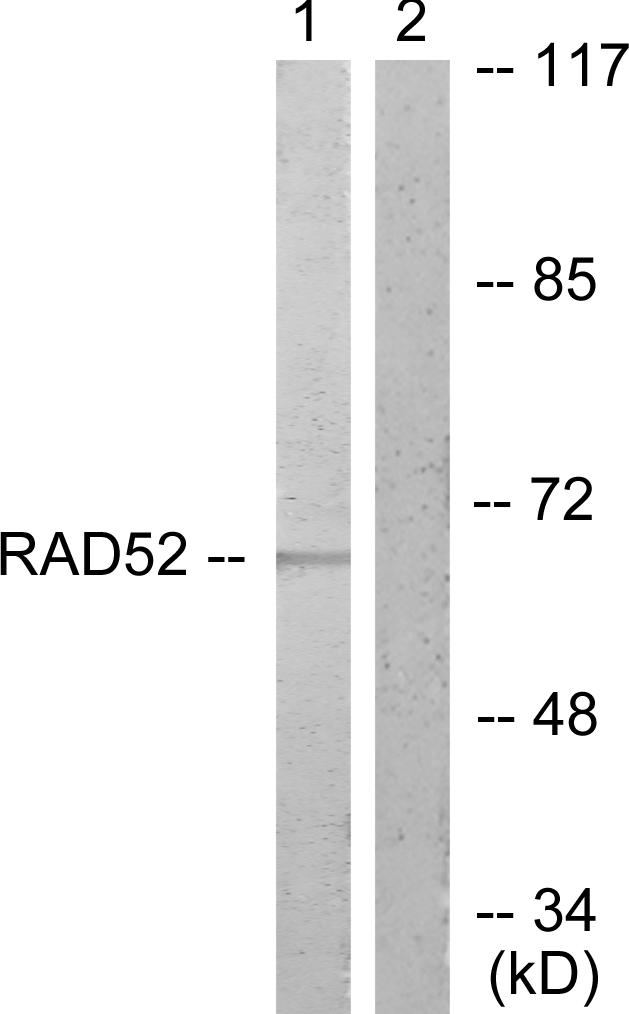 DPYSL2 / CRMP2 Antibody - Western blot analysis of extracts from A549 cells, treated with EGF (200ng/ml, 30mins), using DRP-2 (Ab-514) antibody.