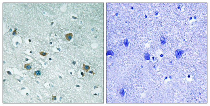 DPYSL2 / CRMP2 Antibody - Immunohistochemistry analysis of paraffin-embedded human brain, using CRMP-2 (Phospho-Thr509) Antibody. The picture on the right is blocked with the phospho peptide.