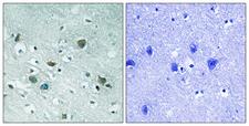 DPYSL2 / CRMP2 Antibody - Immunohistochemistry analysis of paraffin-embedded human brain, using CRMP-2 (Phospho-Thr509) Antibody. The picture on the right is blocked with the phospho peptide.