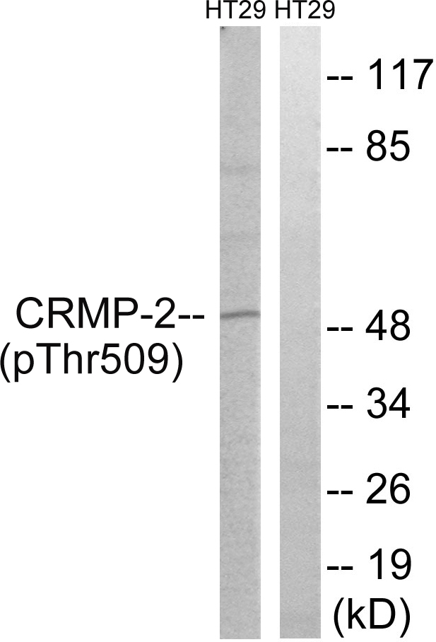 DPYSL2 / CRMP2 Antibody - Western blot analysis of lysates from HT29 cells treated with heat shock, using CRMP-2 (Phospho-Thr509) Antibody. The lane on the right is blocked with the phospho peptide.
