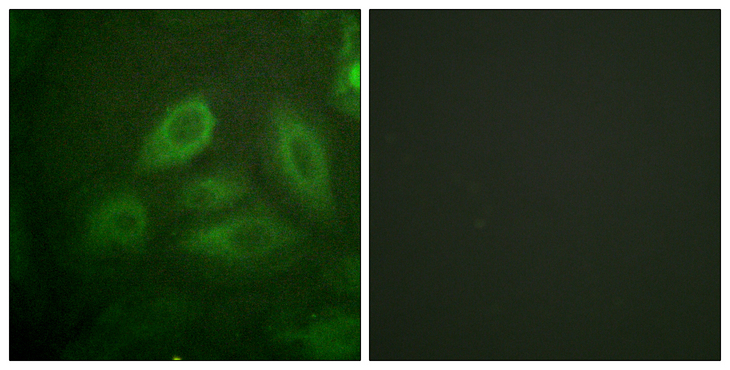 DPYSL2 / CRMP2 Antibody - Immunofluorescence analysis of HeLa cells, using DRP-2 (Phospho-Thr514) Antibody. The picture on the right is blocked with the phospho peptide.
