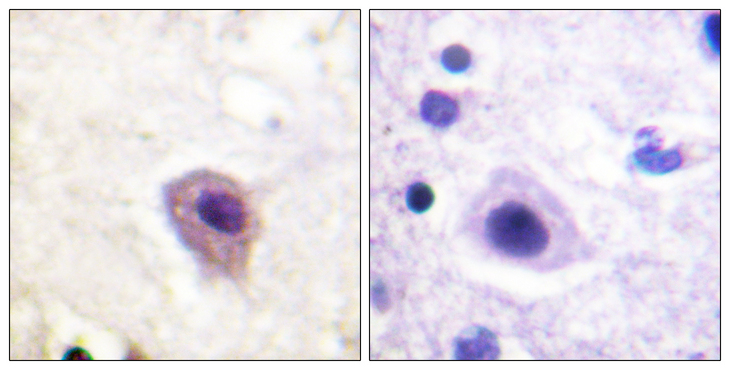 DPYSL2 / CRMP2 Antibody - Immunohistochemistry analysis of paraffin-embedded human brain, using DRP-2 (Phospho-Thr514) Antibody. The picture on the right is blocked with the phospho peptide.