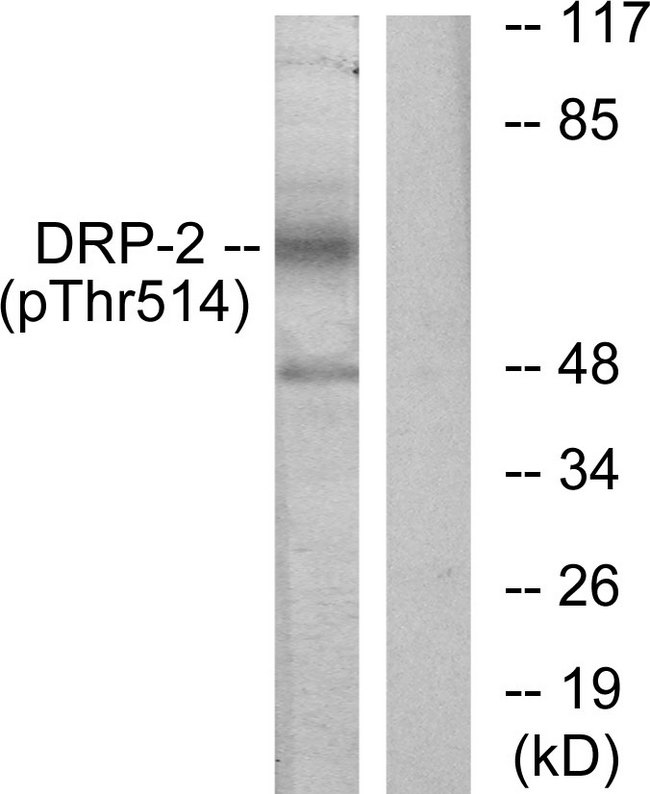 DPYSL2 / CRMP2 Antibody - Western blot analysis of lysates from NIH/3T3 cells treated with PMA 125ng/ml 30', using DRP-2 (Phospho-Thr514) Antibody. The lane on the right is blocked with the phospho peptide.