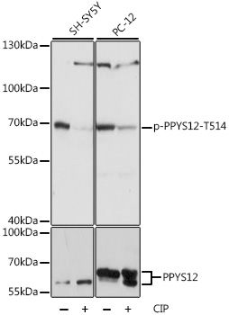 DPYSL2 / CRMP2 Antibody - Western blot analysis of extracts of various cell lines, using Phospho-DPYSL2-T514 antibody at 1:1000 dilution or DPYSL2 antibody. SH-SY5Y cells were treated by CIP(20uL/400ul) at 37â„ƒ for 1 hour. PC-12 cells were treated by CIP(20uL/400ul) at 37â„ƒ for 1 hour. The secondary antibody used was an HRP Goat Anti-Rabbit IgG (H+L) at 1:10000 dilution. Lysates were loaded 25ug per lane and 3% nonfat dry milk in TBST was used for blocking. Blocking buffer: 3% BSA.An ECL Kit was used for detection and the exposure time was 1s.