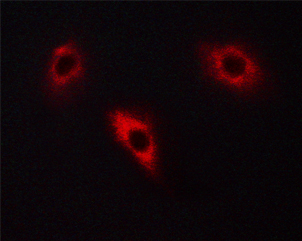 DPYSL2 / CRMP2 Antibody - Staining PC-12 cells by IF/ICC. The samples were fixed with PFA and permeabilized in 0.1% saponin prior to blocking in 10% serum for 45 min at 37°C. The primary antibody was diluted 1/400 and incubated with the sample for 1 hour at 37°C. A Alexa Fluor 594 conjugated goat polyclonal to rabbit IgG (H+L), diluted 1/600 was used as secondary antibody.