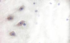 DPYSL2 / CRMP2 Antibody - 1/100 staining human brain tissue by IHC-P. The sample was formaldehyde fixed and a heat mediated antigen retrieval step in citrate buffer was performed. The sample was then blocked and incubated with the antibody for 1.5 hours at 22°C. An HRP conjugated goat anti-rabbit antibody was used as the secondary antibody.