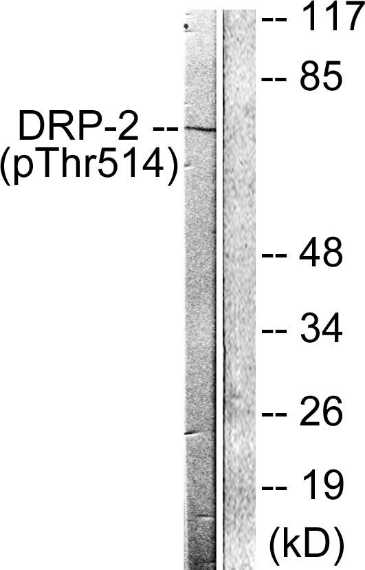 DPYSL2 / CRMP2 Antibody - Western blot analysis of extracts from NIH/3T3 cells, treated with PMA (125ng/ml, 30mins), using DRP-2 (Phospho-Thr514) antibody.