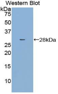 DPYSL3 / CRMP4 Antibody - Western blot of recombinant DPYSL3 / CRMP4.
