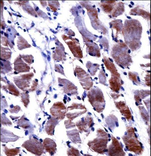 DPYSL3 / CRMP4 Antibody - DPYSL3 Antibody immunohistochemistry of formalin-fixed and paraffin-embedded human skeletal muscle followed by peroxidase-conjugated secondary antibody and DAB staining.