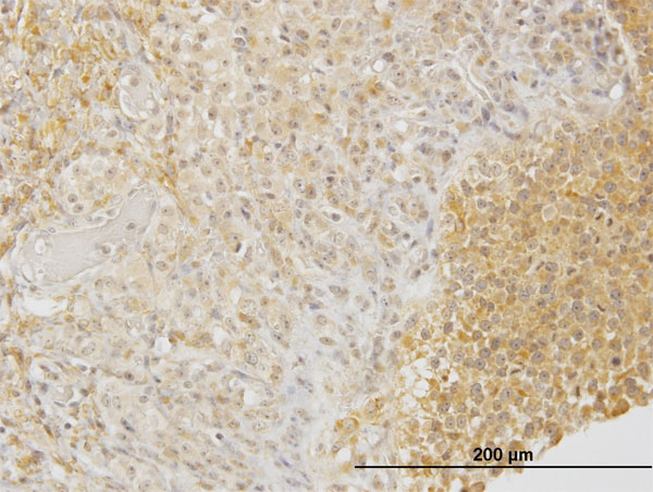 DPYSL3 / CRMP4 Antibody - Immunoperoxidase of monoclonal antibody to DPYSL3 on formalin-fixed paraffin-embedded human ovary. [antibody concentration 3 ug/ml]