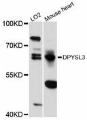 DPYSL3 / CRMP4 Antibody - Western blot analysis of extracts of various cell lines, using DPYSL3 antibody at 1:3000 dilution. The secondary antibody used was an HRP Goat Anti-Rabbit IgG (H+L) at 1:10000 dilution. Lysates were loaded 25ug per lane and 3% nonfat dry milk in TBST was used for blocking. An ECL Kit was used for detection and the exposure time was 15s.