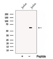 DPYSL3 / CRMP4 Antibody - Western blot analysis of extracts of Jurkat cells using CRMP4 antibody. The lane on the left was treated with blocking peptide.