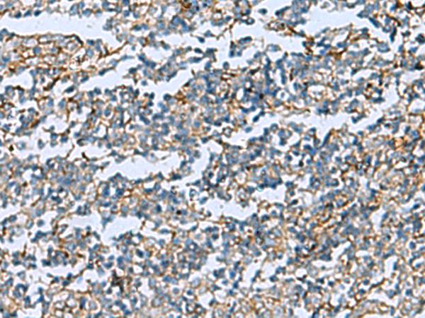 DPYSL3 / CRMP4 Antibody - Immunohistochemistry of paraffin-embedded Human tonsil tissue  using DPYSL3 Polyclonal Antibody at dilution of 1:55(×200)