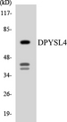DPYSL4 / CRMP3 Antibody - Western blot analysis of the lysates from RAW264.7cells using DPYSL4 antibody.