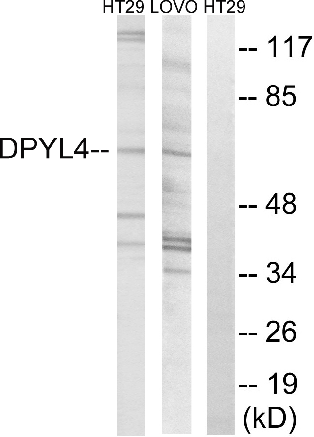 DPYSL4 / CRMP3 Antibody - Western blot analysis of lysates from LOVO and HT-29 cells, using DPYSL4 Antibody. The lane on the right is blocked with the synthesized peptide.