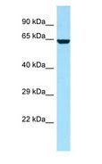 DPYSL4 / CRMP3 Antibody - DPYSL4 / CRMP3 antibody Western Blot of 721_B cell lysate. DPYSL4 is strongly supported by BioGPS gene expression data to be expressed in Human 721_B cells.  This image was taken for the unconjugated form of this product. Other forms have not been tested.