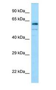 DPYSL4 / CRMP3 Antibody - DPYSL4 / CRMP3 antibody Western Blot of Human brain.  This image was taken for the unconjugated form of this product. Other forms have not been tested.