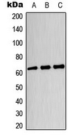 DPYSL4 / CRMP3 Antibody - Western blot analysis of CRMP3 expression in HeLa (A); U87MG (B); HT29 (C) whole cell lysates.