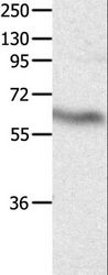 DPYSL4 / CRMP3 Antibody - Western blot analysis of Human fetal brain tissue, using DPYSL4 Polyclonal Antibody at dilution of 1:500.