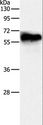 DPYSL4 / CRMP3 Antibody - Western blot analysis of Human fetal brain tissue, using DPYSL4 Polyclonal Antibody at dilution of 1:500.