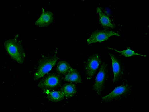 DPYSL4 / CRMP3 Antibody - Immunofluorescent analysis of A549 cells using DPYSL4 Antibody at a dilution of 1:100 and Alexa Fluor 488-congugated AffiniPure Goat Anti-Rabbit IgG(H+L)