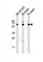 DPYSL5 / CRMP5 Antibody - All lanes : Anti-DPYSL5 Antibody at 1:2000 dilution Lane 1: SH-SY5Y whole cell lysates Lane 2: mouse brain lysates Lane 3: rat brain lysates Lysates/proteins at 20 ug per lane. Secondary Goat Anti-Rabbit IgG, (H+L), Peroxidase conjugated at 1/10000 dilution Predicted band size : 61 kDa Blocking/Dilution buffer: 5% NFDM/TBST.