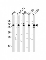 DPYSL5 / CRMP5 Antibody - All lanes : Anti-DPYSL5 Antibody at 1:2000 dilution Lane 1: Y79 whole cell lysates Lane 2: SH-SY5Y whole cell lysates Lane 3: Raji whole cell lysates Lane 4: mouse brain lysates Lane 5: rat brain lysates Lysates/proteins at 20 ug per lane. Secondary Goat Anti-Rabbit IgG, (H+L), Peroxidase conjugated at 1/10000 dilution Predicted band size : 61 kDa Blocking/Dilution buffer: 5% NFDM/TBST.