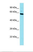 DPYSL5 / CRMP5 Antibody - Western blot of Mouse Brain. Dpysl5 antibody dilution 1.0 ug/ml.  This image was taken for the unconjugated form of this product. Other forms have not been tested.