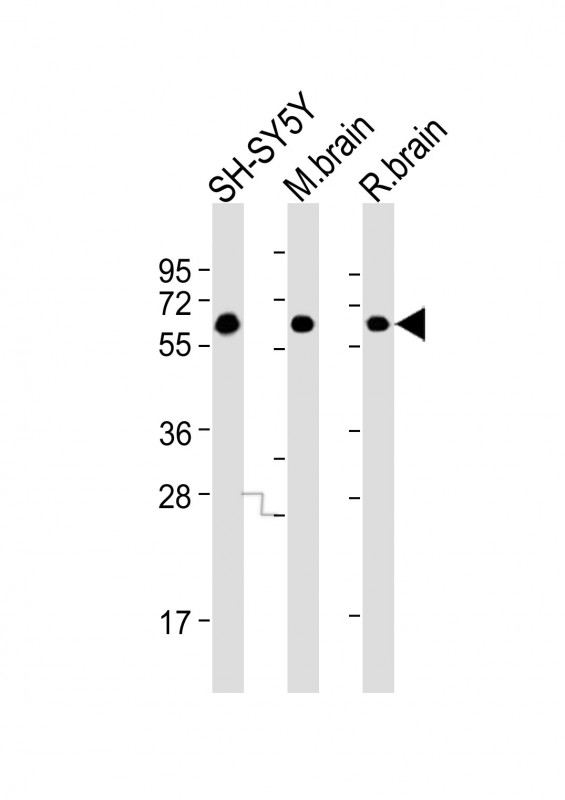 DPYSL5 / CRMP5 Antibody - All lanes: Anti-DPYL5 Antibody at 1:4000 dilution. Lane 1: SH-SY5Y whole cell lysates. Lane 2: mouse brain lysates. Lane 3: rat brain lysates Lysates/proteins at 20 ug per lane. Secondary Goat Anti-mouse IgG, (H+L), Peroxidase conjugated at 1:10000 dilution. Predicted band size: 61 kDa. Blocking/Dilution buffer: 5% NFDM/TBST.