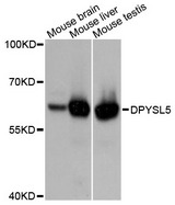 DPYSL5 / CRMP5 Antibody - Western blot analysis of extracts of various cell lines, using DPYSL5 antibody at 1:3000 dilution. The secondary antibody used was an HRP Goat Anti-Rabbit IgG (H+L) at 1:10000 dilution. Lysates were loaded 25ug per lane and 3% nonfat dry milk in TBST was used for blocking. An ECL Kit was used for detection and the exposure time was 90s.