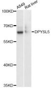 DPYSL5 / CRMP5 Antibody - Western blot analysis of extracts of various cell lines, using DPYSL5 antibody at 1:3000 dilution. The secondary antibody used was an HRP Goat Anti-Rabbit IgG (H+L) at 1:10000 dilution. Lysates were loaded 25ug per lane and 3% nonfat dry milk in TBST was used for blocking. An ECL Kit was used for detection and the exposure time was 1s.