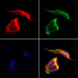 DPYSL5 / CRMP5 Antibody - Staining HeLa cells by IF/ICC. The samples were fixed with PFA and permeabilized in 0.1% Triton X-100, then blocked in 10% serum for 45 min at 25°C. Samples were then incubated with primary Ab(1:200) and mouse anti-beta tubulin Ab(1:200) for 1 hour at 37°C. An AlexaFluor594 conjugated goat anti-rabbit IgG(H+L) Ab(1:200 Red) and an AlexaFluor488 conjugated goat anti-mouse IgG(H+L) Ab(1:600 Green) were used as the secondary antibod
