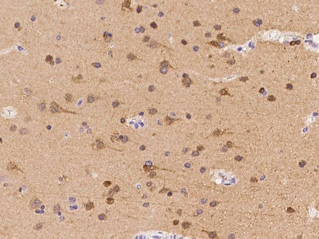 DPYSL5 / CRMP5 Antibody - Immunochemical staining of human DPYSL5 in human brain with rabbit polyclonal antibody at 1:100 dilution, formalin-fixed paraffin embedded sections.