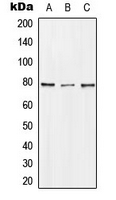 DQX1 Antibody - Western blot analysis of DQX1 expression in Jurkat (A); mouse kidney (B); rat kidney (C) whole cell lysates.
