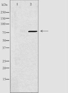DQX1 Antibody - Western blot analysis of extracts of COS-7 cells using DQX1 antibody. The lane on the left is treated with the antigen-specific peptide.