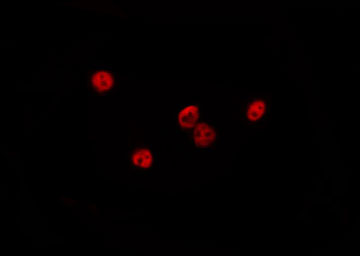DQX1 Antibody - Staining HepG2 cells by IF/ICC. The samples were fixed with PFA and permeabilized in 0.1% Triton X-100, then blocked in 10% serum for 45 min at 25°C. The primary antibody was diluted at 1:200 and incubated with the sample for 1 hour at 37°C. An Alexa Fluor 594 conjugated goat anti-rabbit IgG (H+L) Ab, diluted at 1/600, was used as the secondary antibody.
