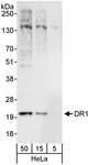 DR1 / NC2 Antibody - Detection of Human DR1 by Western Blot. Samples: Whole cell lysate (5, 15 and 50 ug) from HeLa cells. Antibodies: Affinity purified rabbit anti-DR1 antibody used for WB at 1 ug/ml. Detection: Chemiluminescence with an exposure time of 30 seconds.