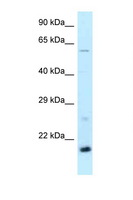 DR1 / NC2 Antibody - DR1 antibody Western blot of Mouse Kidney lysate. Antibody concentration 1 ug/ml.  This image was taken for the unconjugated form of this product. Other forms have not been tested.