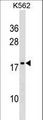 DR1 / NC2 Antibody - DR1 Antibody western blot of K562 cell line lysates (35 ug/lane). The DR1 antibody detected the DR1 protein (arrow).