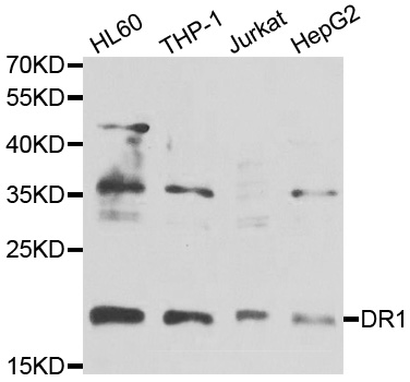 DR1 / NC2 Antibody - Western blot analysis of extracts of various cell lines.