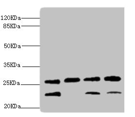 DR1 / NC2 Antibody - Western blot All Lanes:DR1 antibody at 2.32ug/ml Lane 1:rat gonad tissue Lane 2:PC-3 whole cell lysate Lane 3:Hela whole cell lysate Lane 4:293T whole cell lysate Secondary Goat polyclonal to rabbit at 1/10000 dilution Predicted band size: 19kDa Observed band size: 23kDa,26kDa