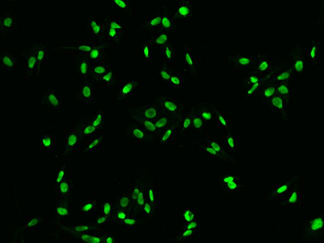 DR1 / NC2 Antibody - Immunofluorescence staining of DR1 in PC3 cells. Cells were fixed with 4% PFA, permeabilzed with 0.1% Triton X-100 in PBS, blocked with 10% serum, and incubated with rabbit anti-Human DR1 polyclonal antibody (dilution ratio 1:200) at 4°C overnight. Then cells were stained with the Alexa Fluor 488-conjugated Goat Anti-rabbit IgG secondary antibody (green). Positive staining was localized to Nucleus.