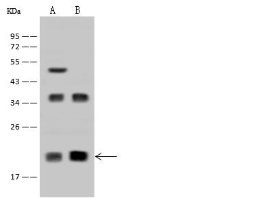 DR1 / NC2 Antibody - Anti-DR1 rabbit polyclonal antibody at 1:500 dilution. Lane A: HeLa Whole Cell Lysate. Lane B: Jurkat Whole Cell Lysate. Lysates/proteins at 30 ug per lane. Secondary: Goat Anti-Rabbit IgG (H+L)/HRP at 1/10000 dilution. Developed using the ECL technique. Performed under reducing conditions. Predicted band size: 19 kDa. Observed band size: 19 kDa.