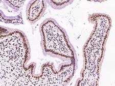 DR1 / NC2 Antibody - Immunochemical staining of human DR1 in human gallbladder with rabbit polyclonal antibody at 1:200 dilution, formalin-fixed paraffin embedded sections.