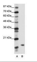 DR1 / NC2 Antibody - A: Marker, B: Transfected 293T Cell Lysate.  This image was taken for the unconjugated form of this product. Other forms have not been tested.
