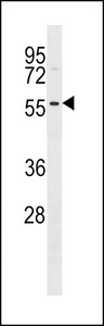 DRAK1 / STK17A Antibody - DRAK1 Antibody (P14) western blot of SK-BR-3 cell line lysates (35 ug/lane). The DRAK1 antibody detected the DRAK1 protein (arrow).