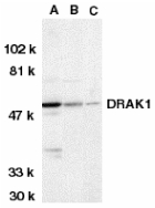 DRAK1 / STK17A Antibody - Western blot of DRAK1 in MOLT4 (A), A431 (B), and 3T3 (C) whole cell lysates with DRAK1 antibody at 1 ug/ml.