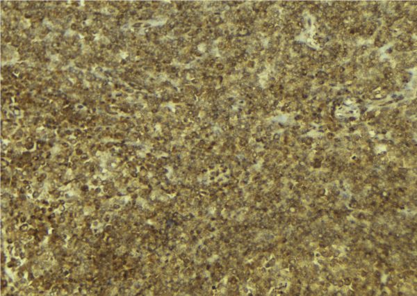 DRAK1 / STK17A Antibody - 1:100 staining mouse pancreas tissue by IHC-P. The sample was formaldehyde fixed and a heat mediated antigen retrieval step in citrate buffer was performed. The sample was then blocked and incubated with the antibody for 1.5 hours at 22°C. An HRP conjugated goat anti-rabbit antibody was used as the secondary.