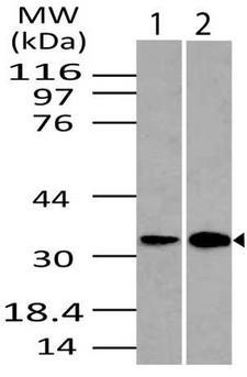 DRAM1 / DRAM Antibody - Fig-1: Western blot analysis of DRAM. Anti- DRAM antibody was used at 4 µg/ml on (1) Kidney and (2) Lungs lysates.