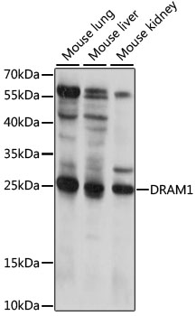 DRAM1 / DRAM Antibody - Western blot analysis of extracts of various cell lines, using DRAM1 antibody at 1:1000 dilution. The secondary antibody used was an HRP Goat Anti-Rabbit IgG (H+L) at 1:10000 dilution. Lysates were loaded 25ug per lane and 3% nonfat dry milk in TBST was used for blocking. An ECL Kit was used for detection and the exposure time was 15s.